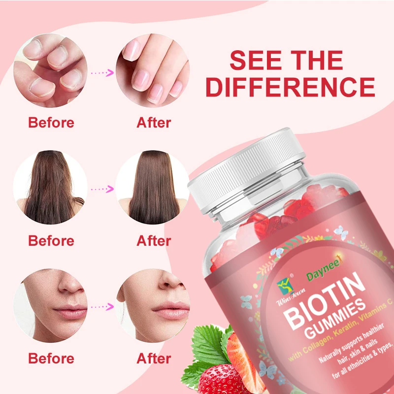 60 Capsules Biotin Soft Candy Improves Skin Nail Health While Promoting Hair Growth Enhancing Skin Elasticity Health Food