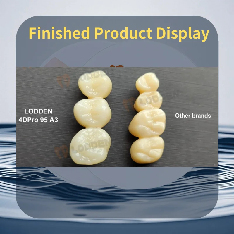 Рисунок 5 - Lodden 4D Pro Многослойные циркониевые