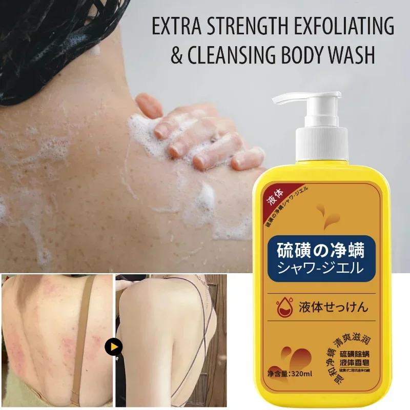 320ml Sulfur Liquid Mite Removal Soap Shower Gel Deep Cleansing Whole Body Acne Body Wash Body Cleansers