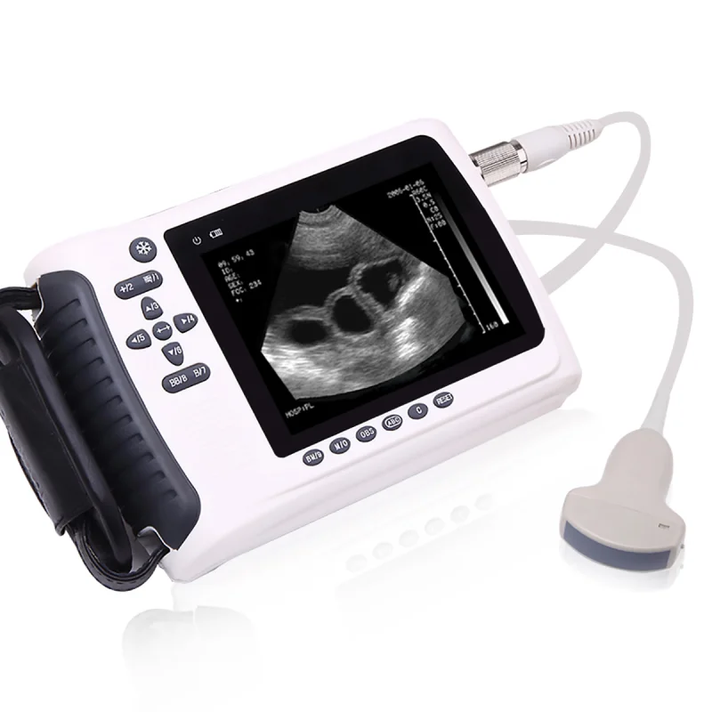 Medco Medical Equipment Veterinary Digital Handheld Ultrasound Machine Ultrasound Scanner