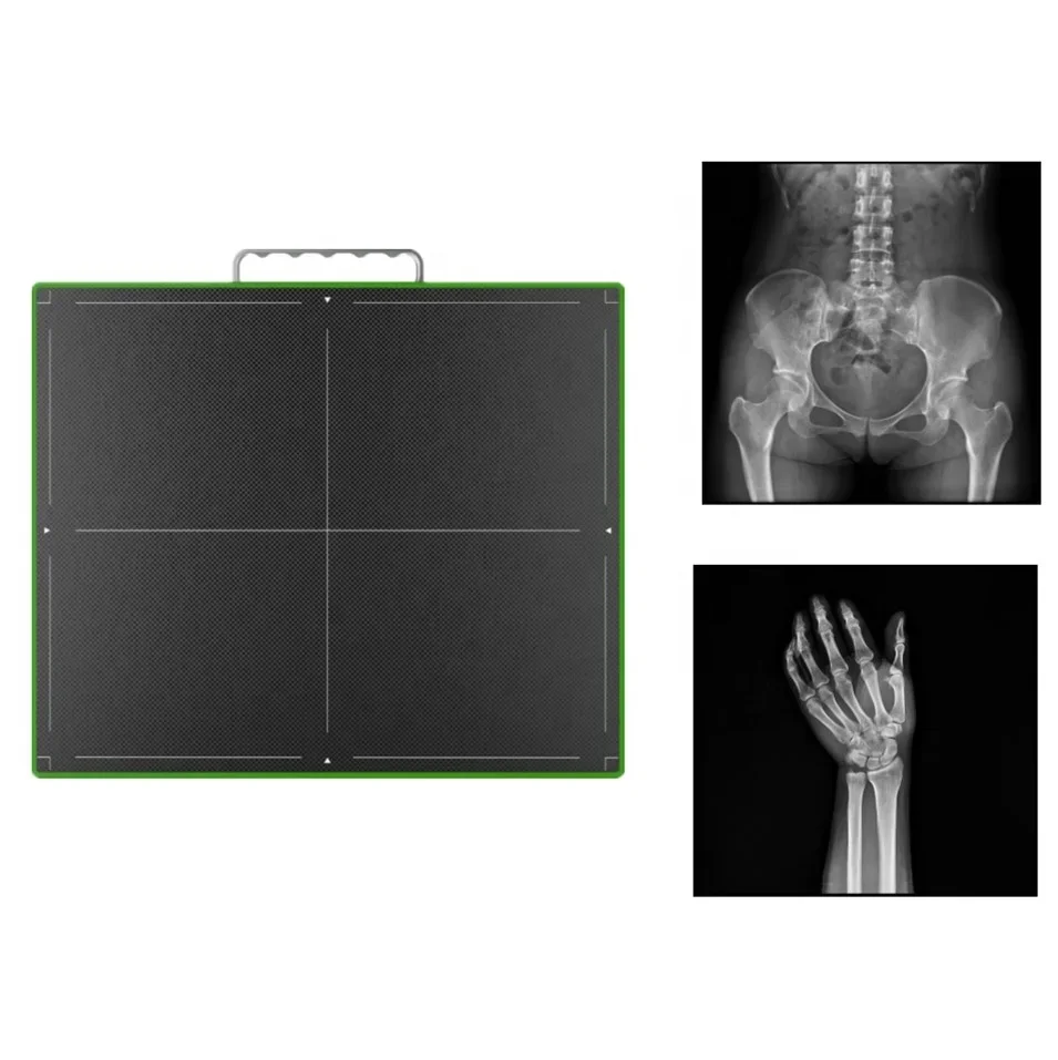 Flat Panel Detector X-ray Machine / Radiography Diagnostic Digit Xray Flat Panel Detector