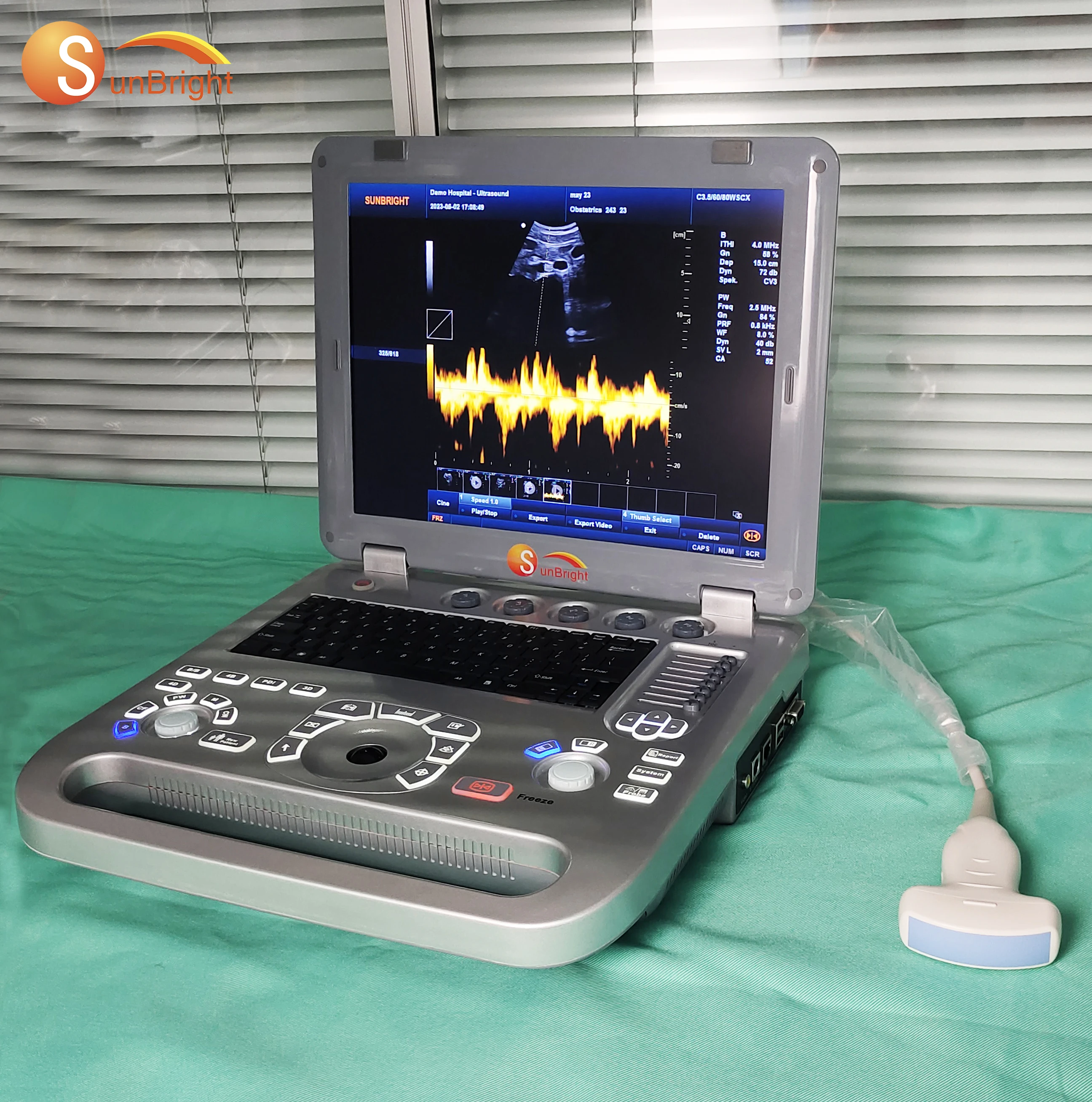 Pulse Wave Doppler Medical 15 Inch PC-based Vet Ultrasound Device