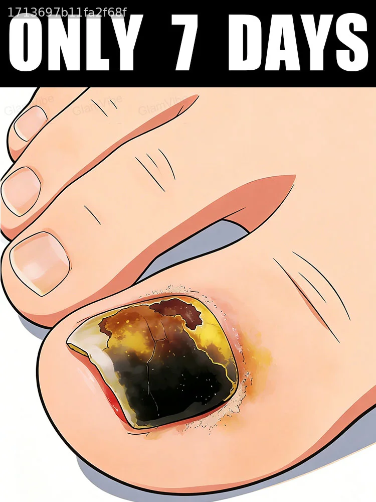 

Reduce your anxiety and stop constantly worrying about your nails.