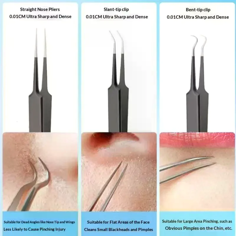 /Kuz/Removal Tool Blackheads Remover Face Cleaning Kit Black Dots Remover Tool Pimple Patches Set Pimple