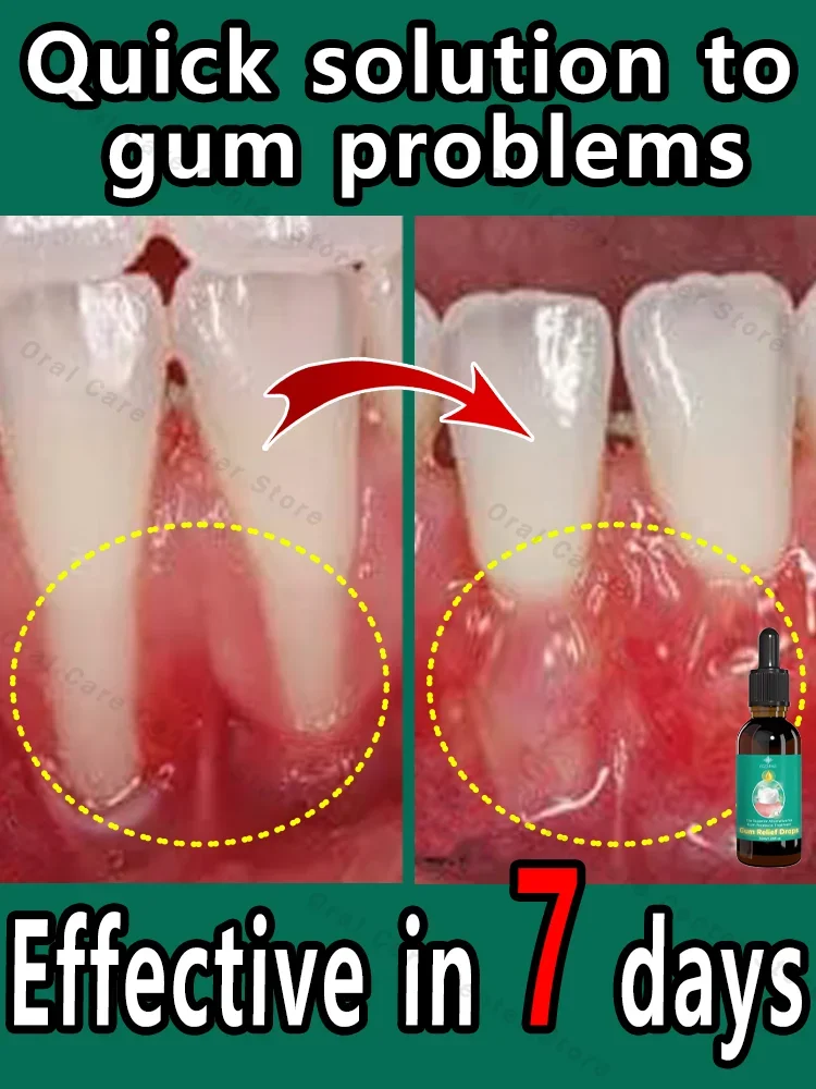 Effectively repair damaged gums, relieve toothache, strengthen teeth and strengthen gums