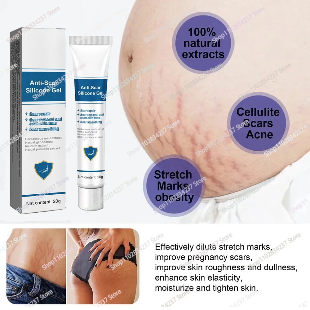 Permanent Stretch Marks Removal Cream Skin Anti-Wrinkle Pregnancy Body Cream