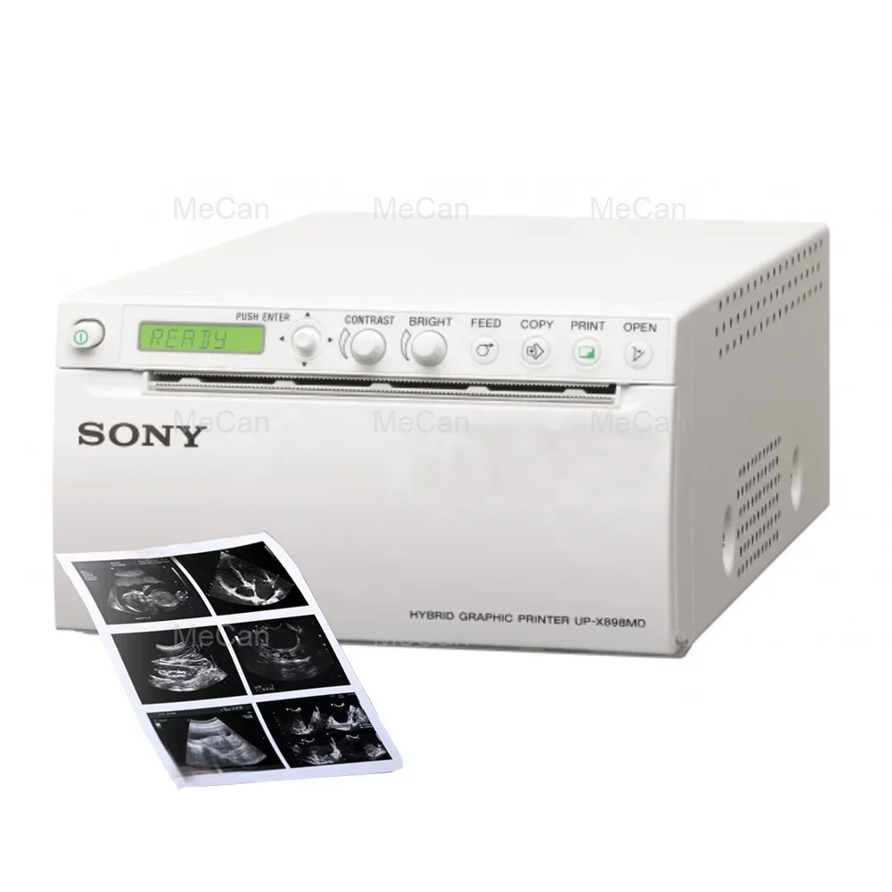 Portable 3D 4D Thermal Color Ultrasound Printer Digital Graphic Ultrasound Video Printer