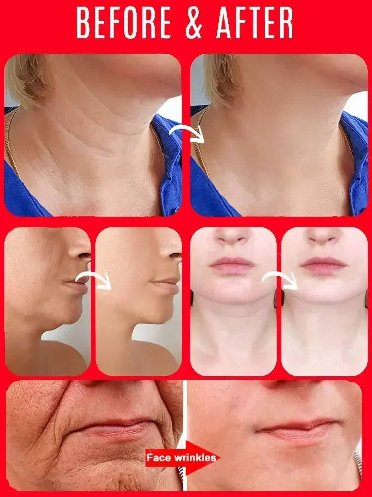 Gezicht Moisturizer Anti Aging Serum Anti-rimpel Gezichtsserum Rimpels verwijderen Fijne lijntjes rond de ogen Kraaienpootjes Nekrimpel