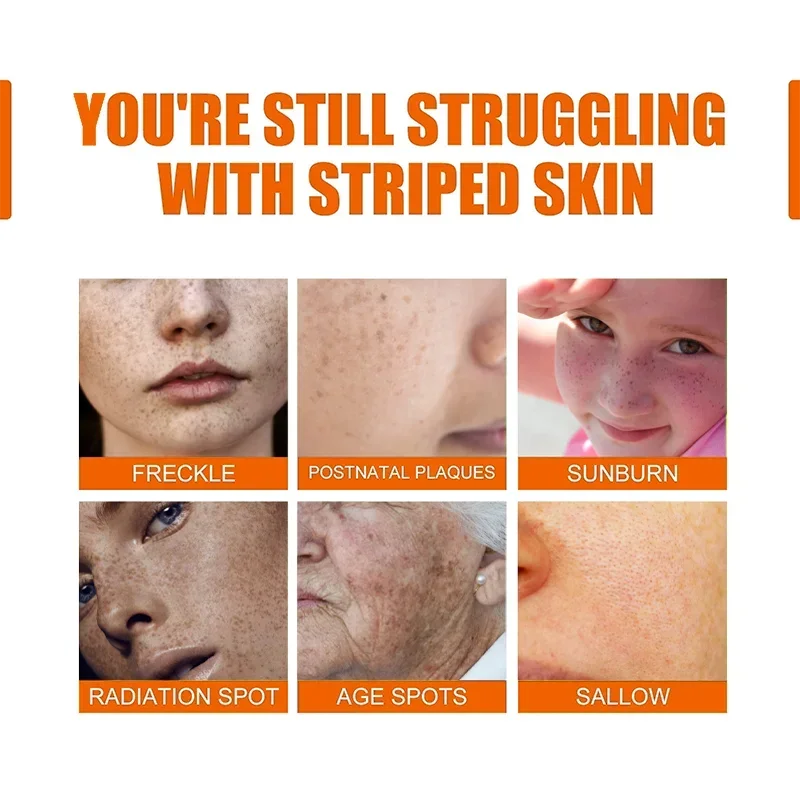 Suero blanqueador que elimina la melanina, manchas de la edad, Chloasma, pecas, ilumina, hidrata y repara la esencia Facial