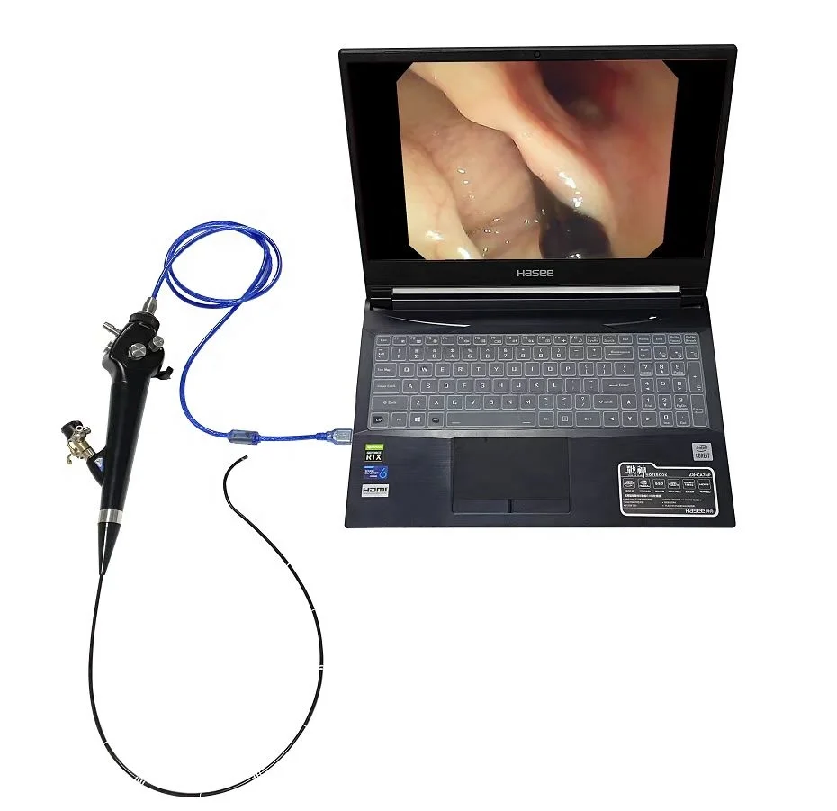 Veterinary Flexible Endoscope Fiber Ureteroscope Video Endoscope Tower Camara Endoscopio Fibroscope GBS-3