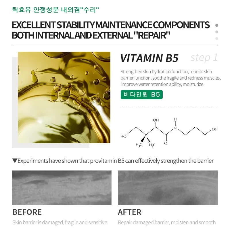 إصلاح احمرار الوجه مصل لحظة العنكبوت الوريد إزالة الجلد الحساسة تهدئة مكافحة احمرار Rosacea علاج غسول مستحضرات التجميل الكورية