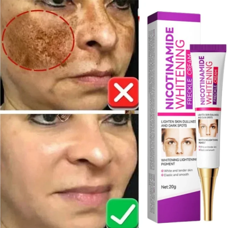 

Ниацинамидный осветляющий крем для лица Weaken Chloasma Melasma Melanin Fade Fine Lines Осветляющая сыворотка для темной кожи Уход Осветляющий крем