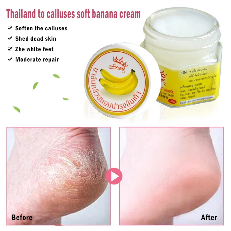 Crema reparadora antigrietas para pies y manos, crema hidratante para eliminar piel muerta, talón agrietado, cuidado suave, Banana 제거 거