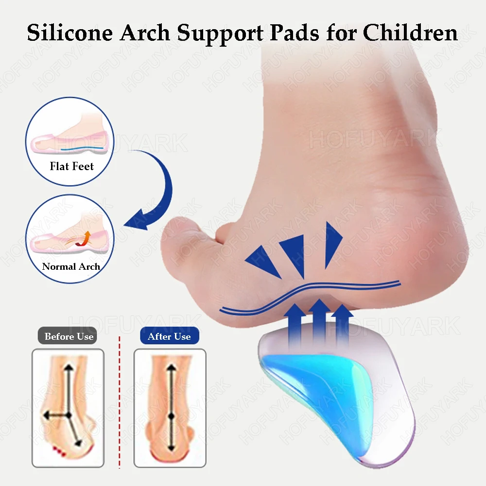 Silicone Arch Support Orthopedic Insoles for Kids Flat Feet X-Type Legs Corrector Children Plantar Fasciitis Support Shoes Pads