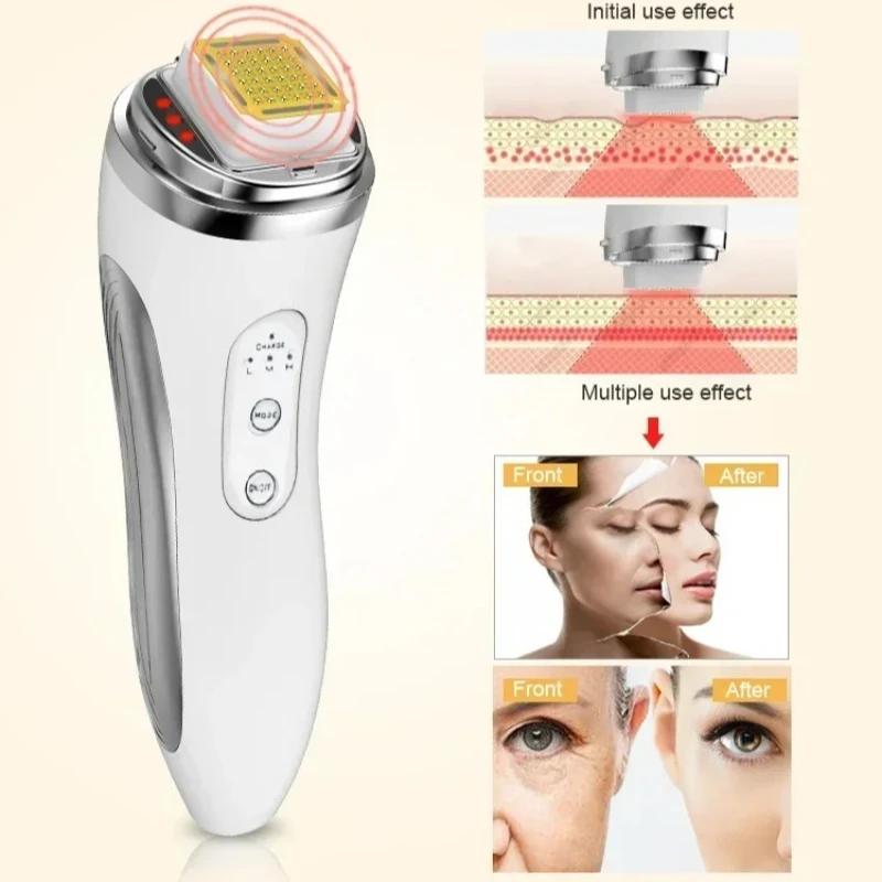 Thumbnail 4 - #64 Best Facial Lifting Devices to Buy In 2026