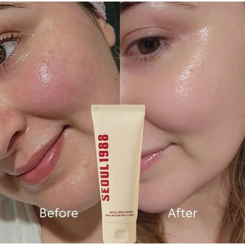 سيول 1988 كريم نياسيناميد 100 مل ريتينول 2% الجينسنغ جوهر ثبات كريم عين اشراق ترطيب عميق مجموعة جوهر الرعاية #3