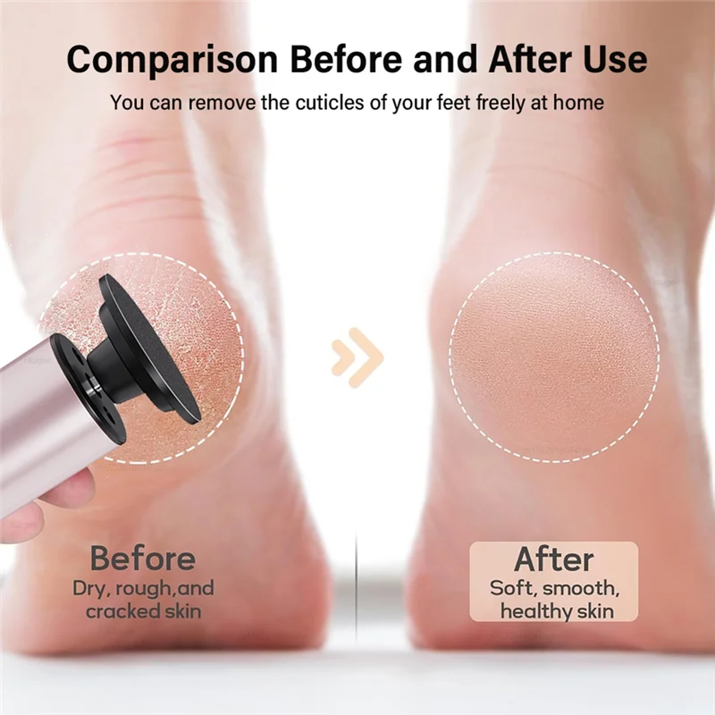 ABVI-Callus Removal Pedicure Machine Electric Foot Grinder For Feet Exfoliation File Sander