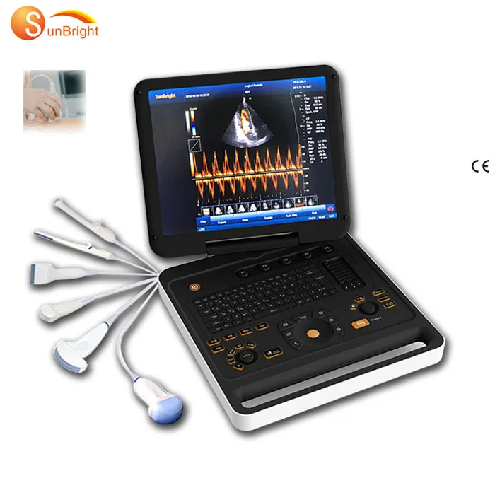 128 Elements Full Digital 3D 4D Color Doppler Ultrasonic Diagnostic System Medical Usg Scanner