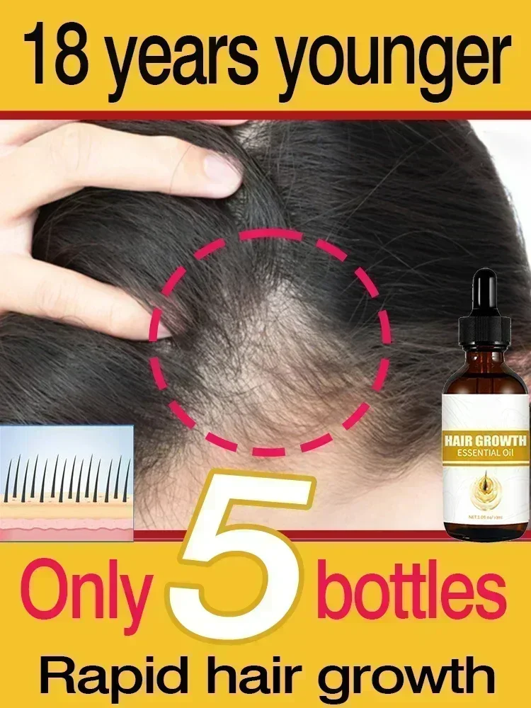 Hot sales Fast Hair Growth Baldness Repair Seborrheic Hereditary for men women