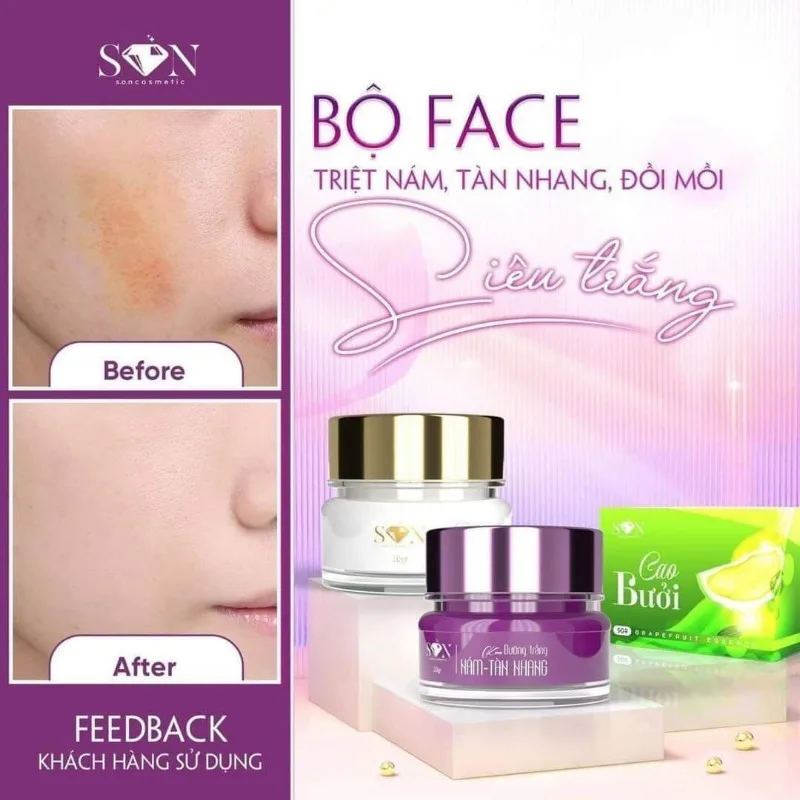 Kem Face SON Cô Tiên, Tặng Kèm Cao Buoi, Combo Ngay Dem Tri Nam Tan,Anti-aging Cream Whitening,removing Spots Diluting Melanin