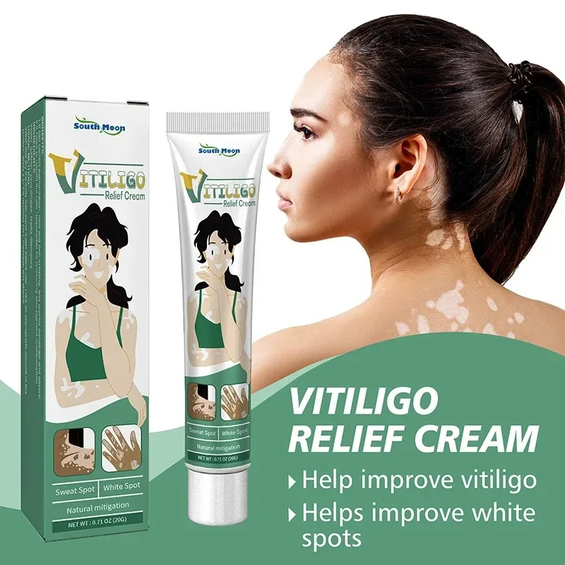 Vitiligo Zalf Kruidenextract Verwijderen Ringworm Witte Vlek Verwijdering Huid Vitiligo Elimineren Vitiligo Behandelingscrème