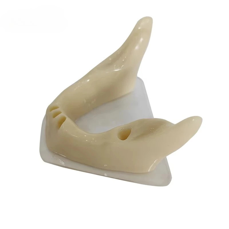 DentalS Implants Provide An Anatomically Shaped Mandible for ImplantS Placement Practices