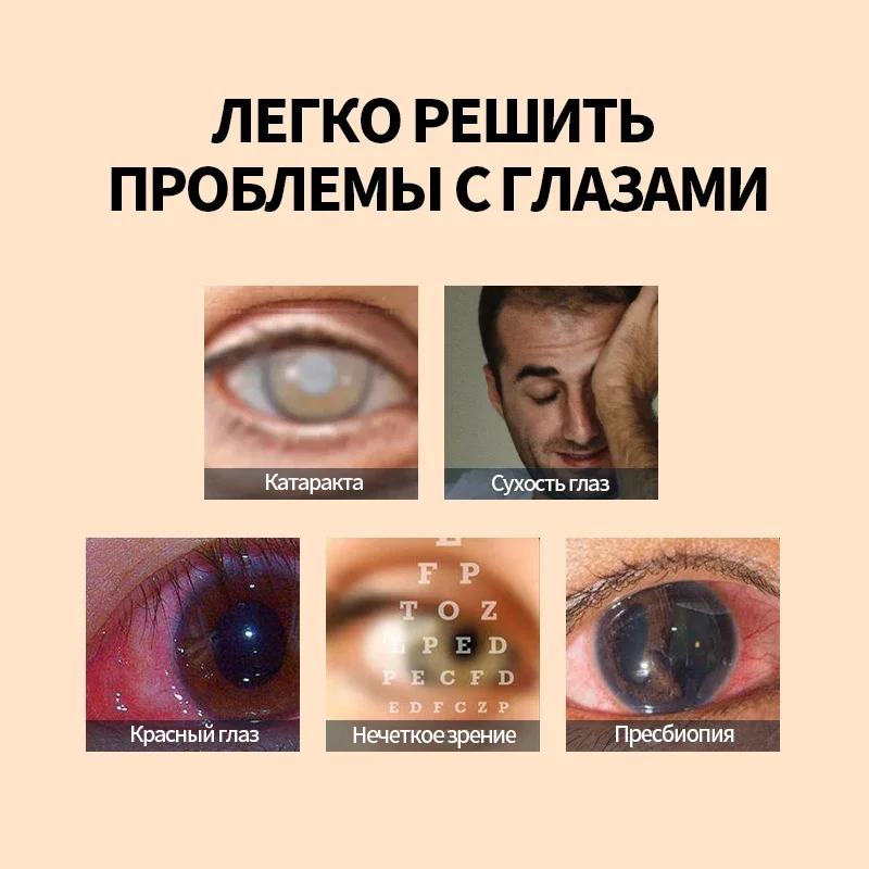 Blueberry Lutein Cataract Eye Drops Protect Vision Eyes Pain Dry Itchy Visual Fatigue Myopia Removal Care Russian Language
