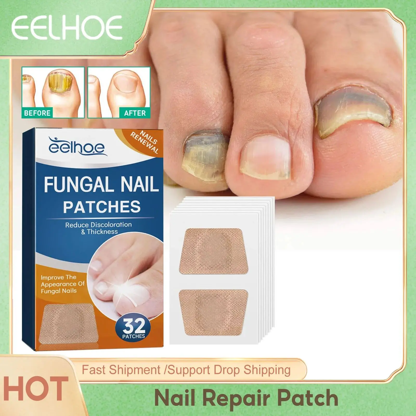 Fungal Nail Treatment Patch Ingrown Toenail Paronychia Anti Infection Correction Repair Damaged Foot Nail for Nails Care 32pcs