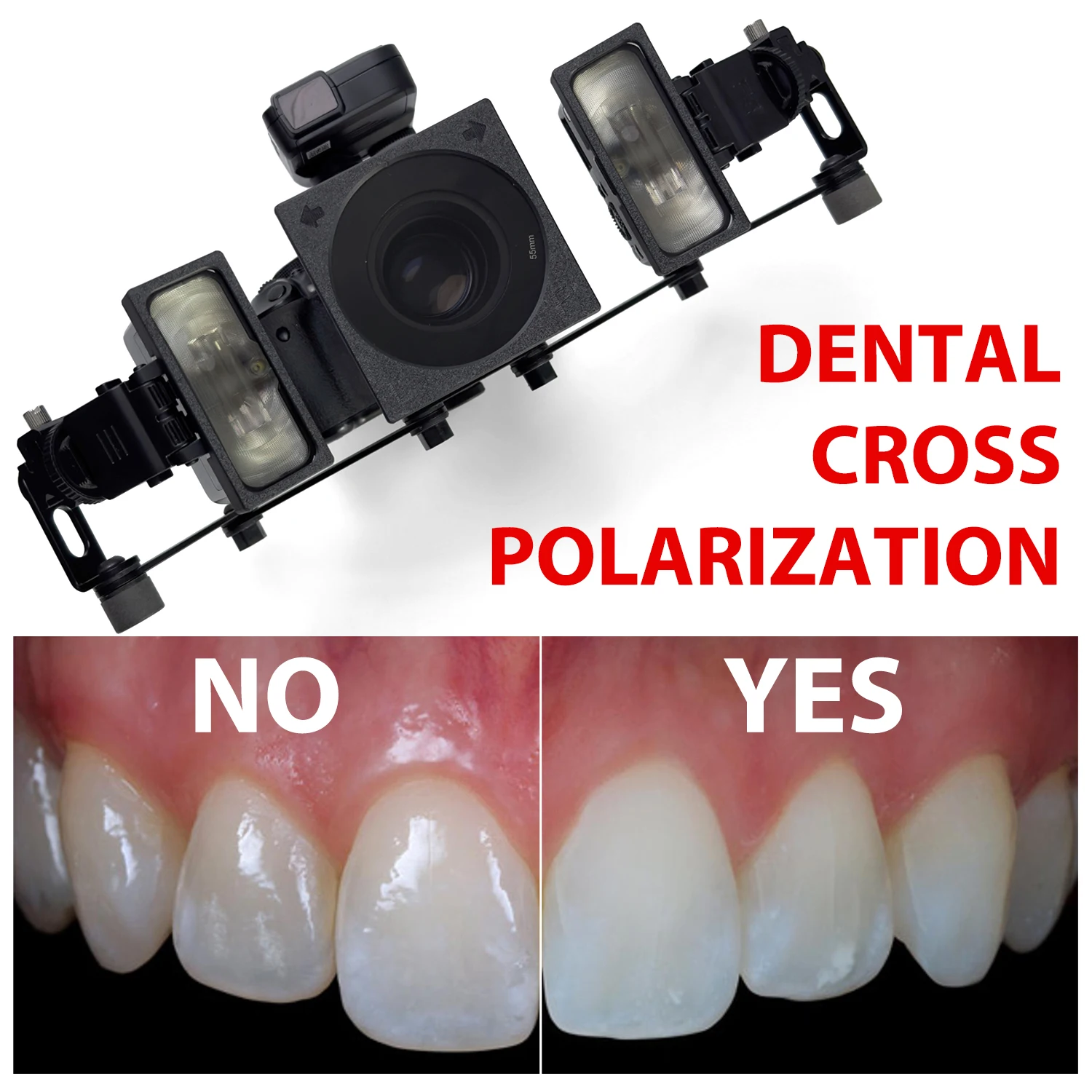 

Dental Cross Polarization Kit For Godox MF12 Camera Flash - No Reflections, No Glare Camera Polarization Photo Kit For Dentist