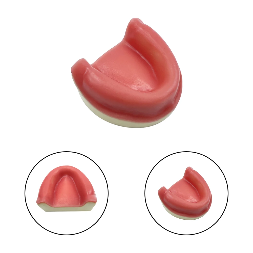 Dental Implant Model Training Maxillary Edentulous Model With Soft Gums Simplified Implant Model Suitable For Students Practice