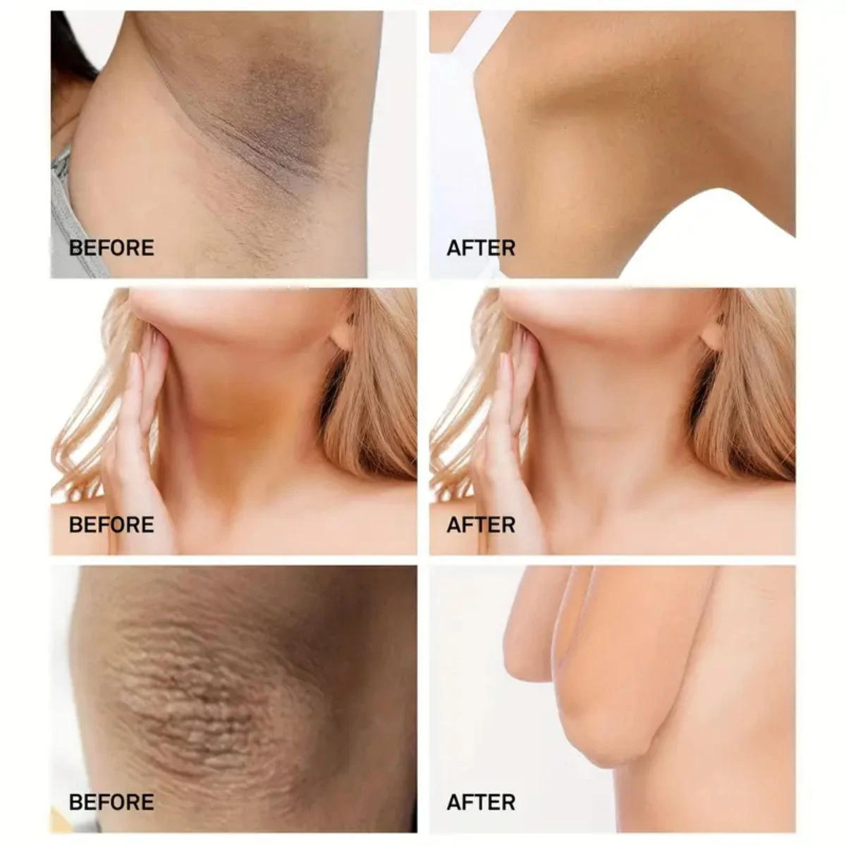 La crema sbiancante TRSTAY per la cura della pelle rimuove la pigmentazione locale migliora la differenza del colore della pelle per aree private e articolazioni