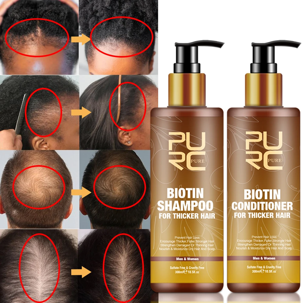 PURC Smoothing Hair Scalp Treatment Hair Shampoo Biotin Hair Oil and Conditioner Set for Men Women Hair Care