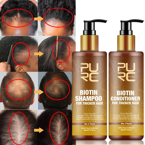 PURC 스무딩 헤어 두피 트리트먼트 헤어 샴푸, 비오틴 헤어 오일 및 컨디셔너 세트, 남성 여성 헤어 케어