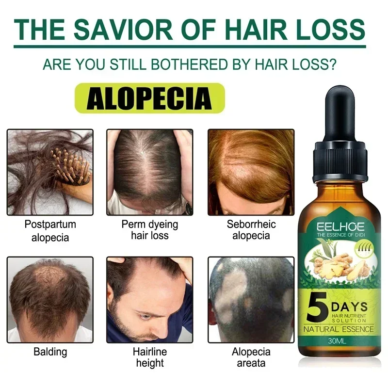 Aceite Esencial Natural de jengibre para el crecimiento rápido del cabello, pérdida de cabello tratamiento Anti, previene la calvicie, nutre el crecimiento rápido, seca y dañada, 5 días