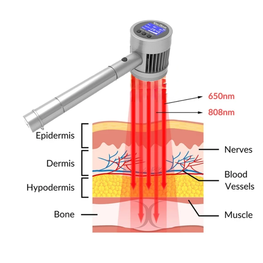 

3W Physio Laser Device 6x808nm+19x650nm - Infrared Red Light Machine for Knee Pain & Chronic Pain Relief