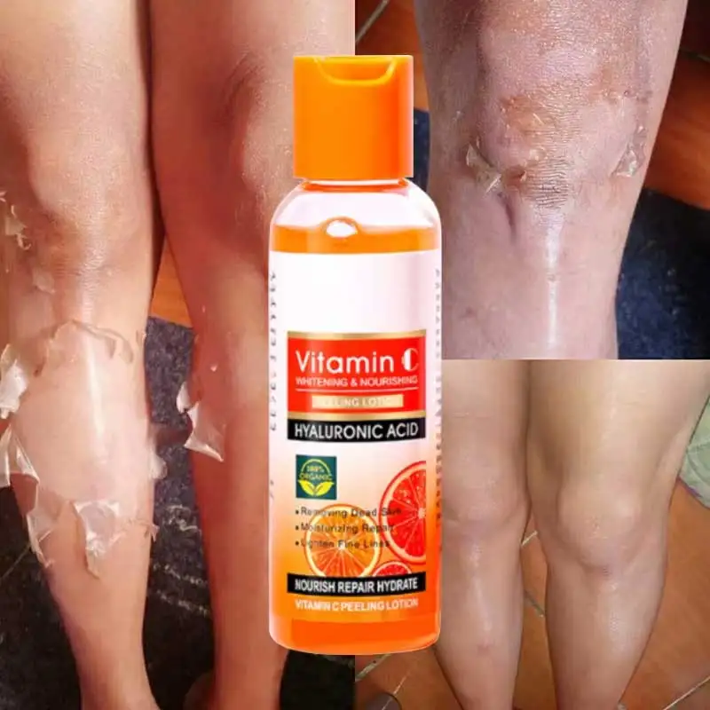 100g Vitamin c Lotion, For Dark Skin Lightening Melanin Knuckle Knee Elbow Moisturizing Uniform Skin Tone Smooth Body Skin Care