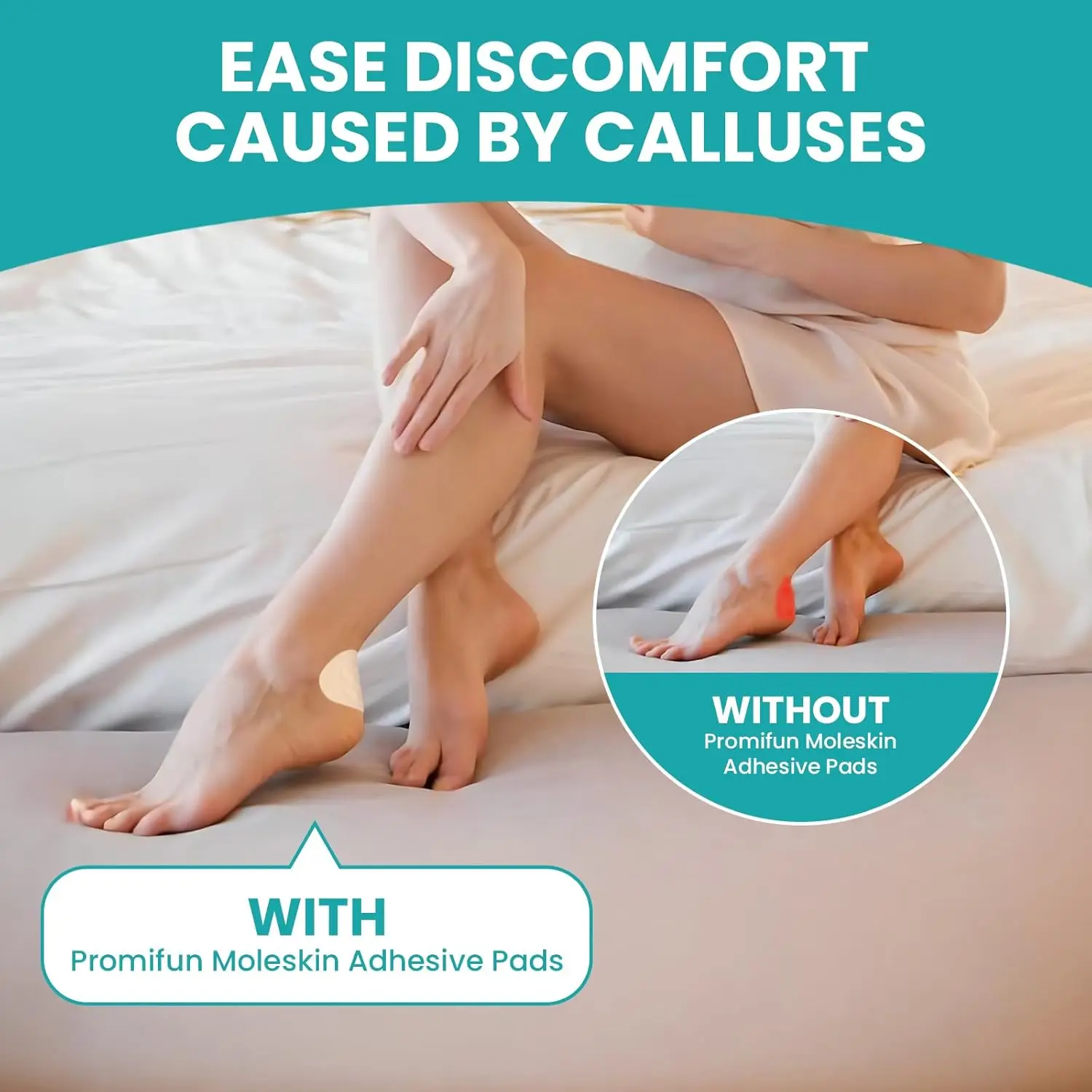 Рисунок 4 - 4 типа Sumifun клейкие подушечки из молескина