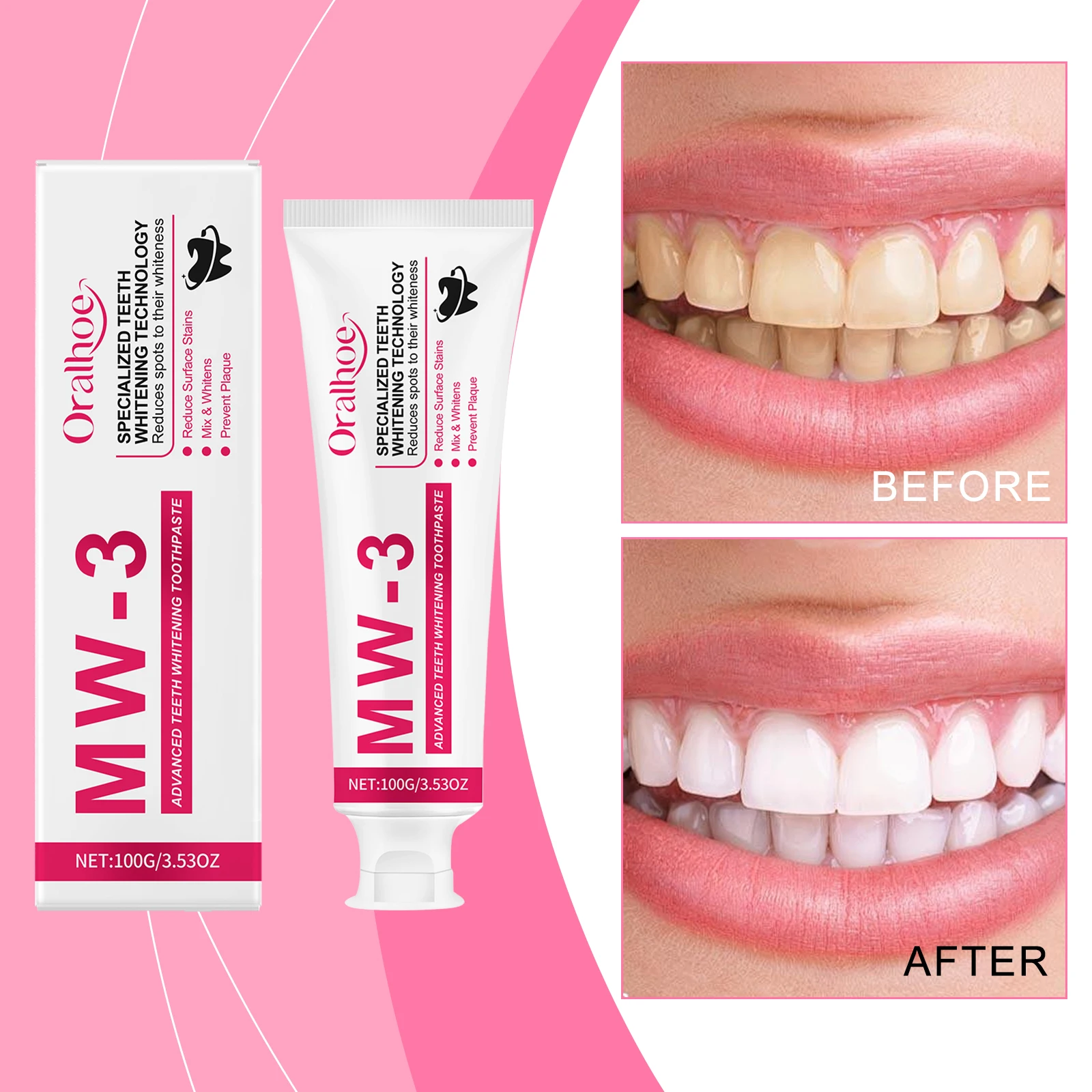 Zahnpasta zur Aufhellung von Fleckenentfernung, Entfernung von Flecken, Zahnstein, Mundgeruch, Aufhellung der Zähne, frischer Atem, stärkende Zahnschmelz