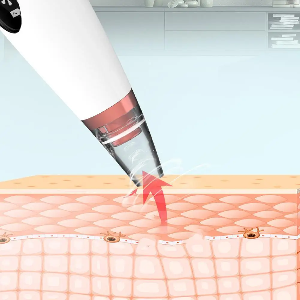 Facial Pore Comedondrukker USB Oplaadbare Mee-eter Zuigkit Met 6 soorten zuigkop Pore Cleaning Care Tool