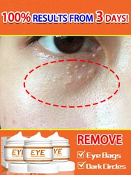 Anti-Wrinkle Dark Circles Eye cream Remove eye bags Puffiness way work under eyes Lightening Moisturizing Whitening Skin Care