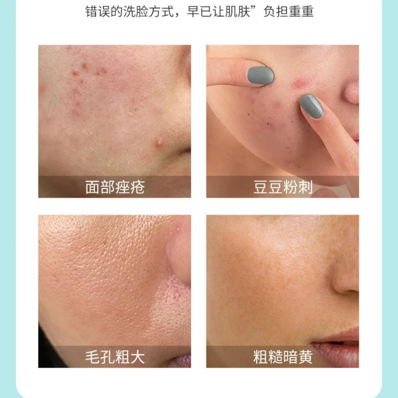 Schoonheidsapparatuur voor gezichtslift en verstevigende massage Siliconenreiniger Heet kompres Foton Radiofrequentie-introductieapparaat