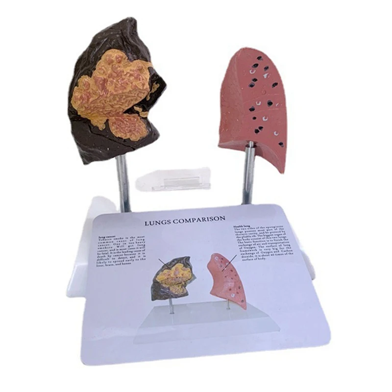 Healthy Lung Model Lung Anatomy Model With Pathological Respiratory System Disease Lungs