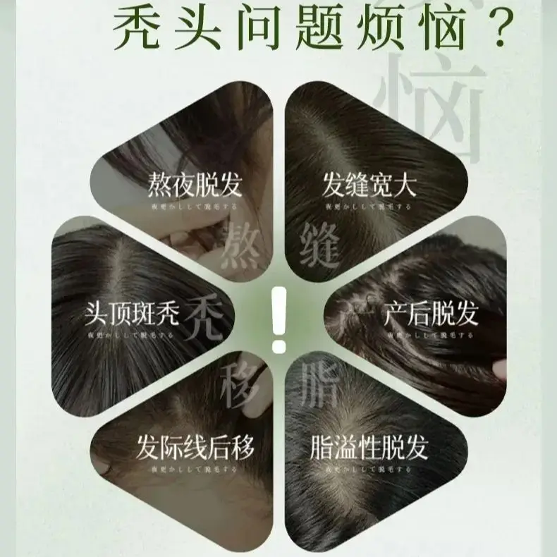 صابون شامبو للتحكم في القشرة مصنوع يدويًا حرفية Cacumen Platycladi شينجيانغ Usma Grass Polygonum Multiflorum صحة فروة الرأس #6