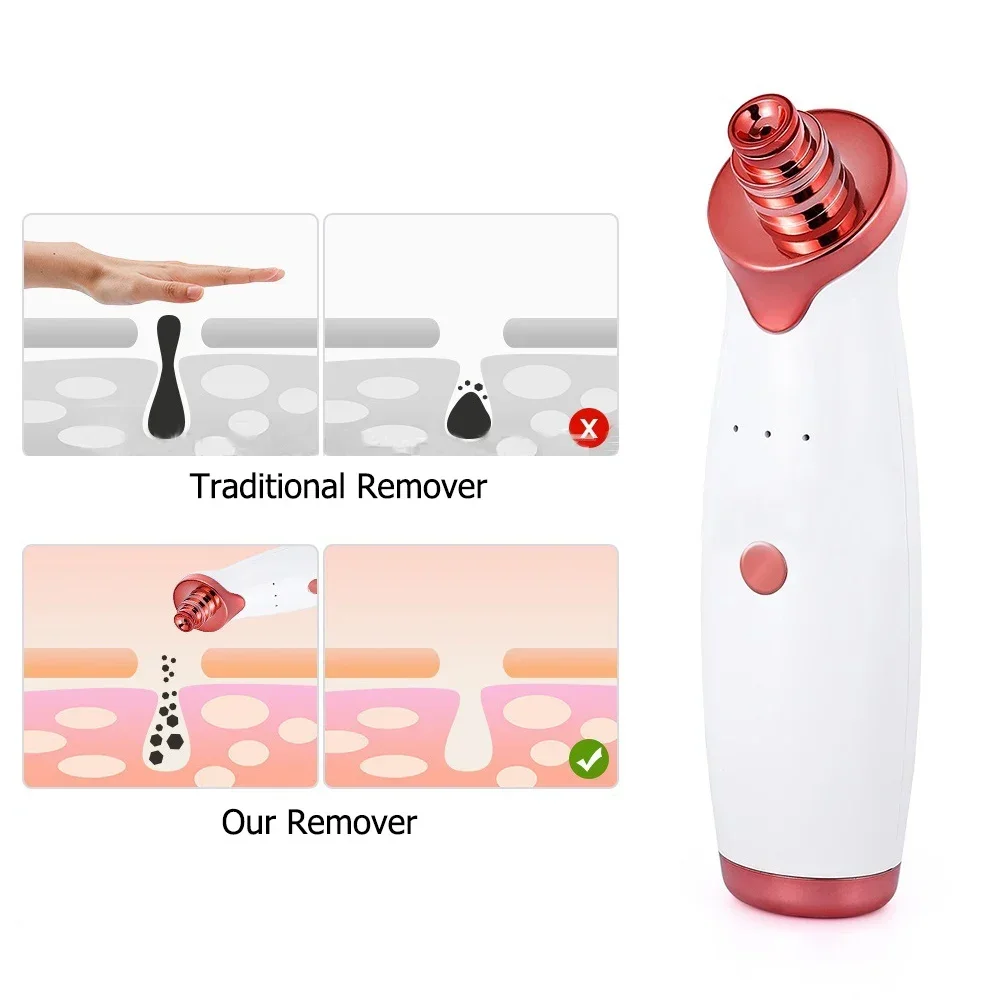 Comedondrukker Porie Vacuüm Elektrische Schoonheid Neus Gezicht Diepe Reiniging Huidverzorging Whitehead Zwarte Vlekken Acne Cleaner Puistje Tool