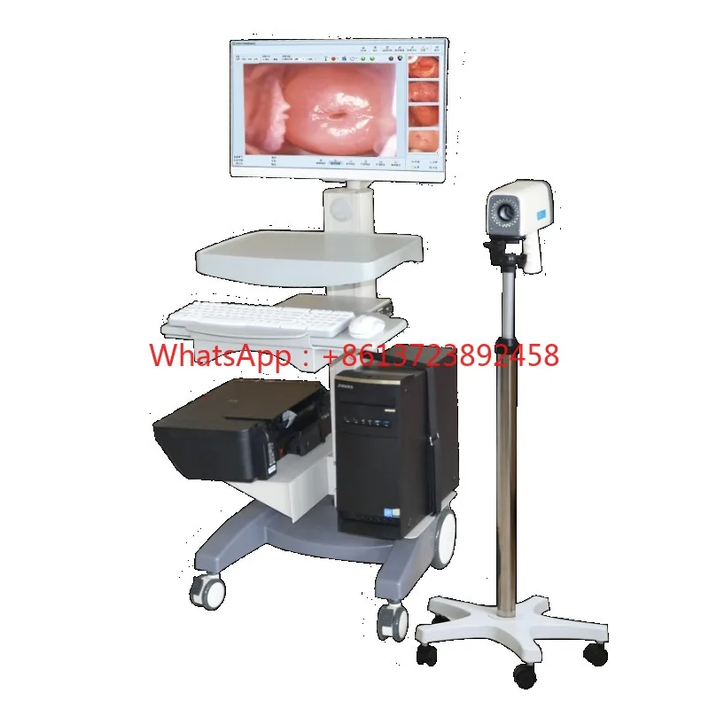 Hospital digital good quality full HD Colposcope documentary workstation with trolley and computer