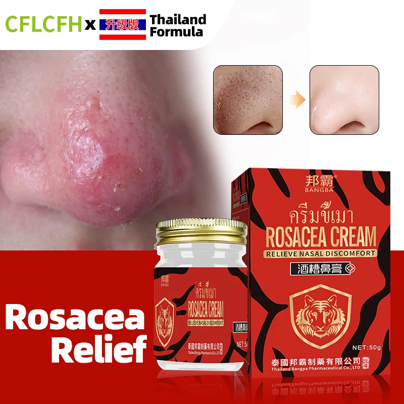 Thailand Rosacea Treatment Cream Blackhead Acne Remover Red Nose Face Shrink Pores Anti Nose Mites Repair Skin Care