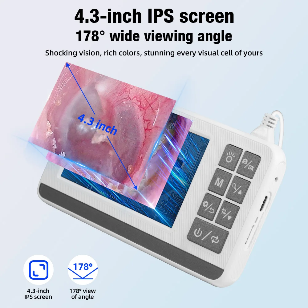 KERUI 3.9mm 귀 내시경 카메라 (6개 조명 포함) 4.3인치 화면 귀지 제거 도구 (어린이 및 성인용) P60