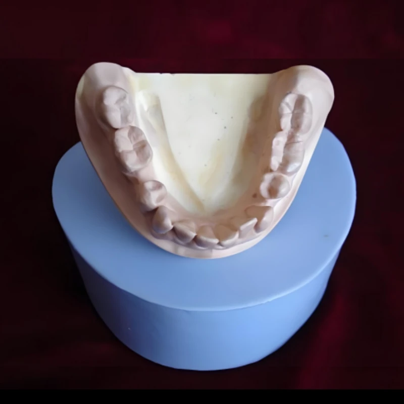 

2Pcs Silicone Blue Plaster Teeth Model Mold Standard Full Teeth Gypsum Mould Base Dentistry Lab Tool ﻿