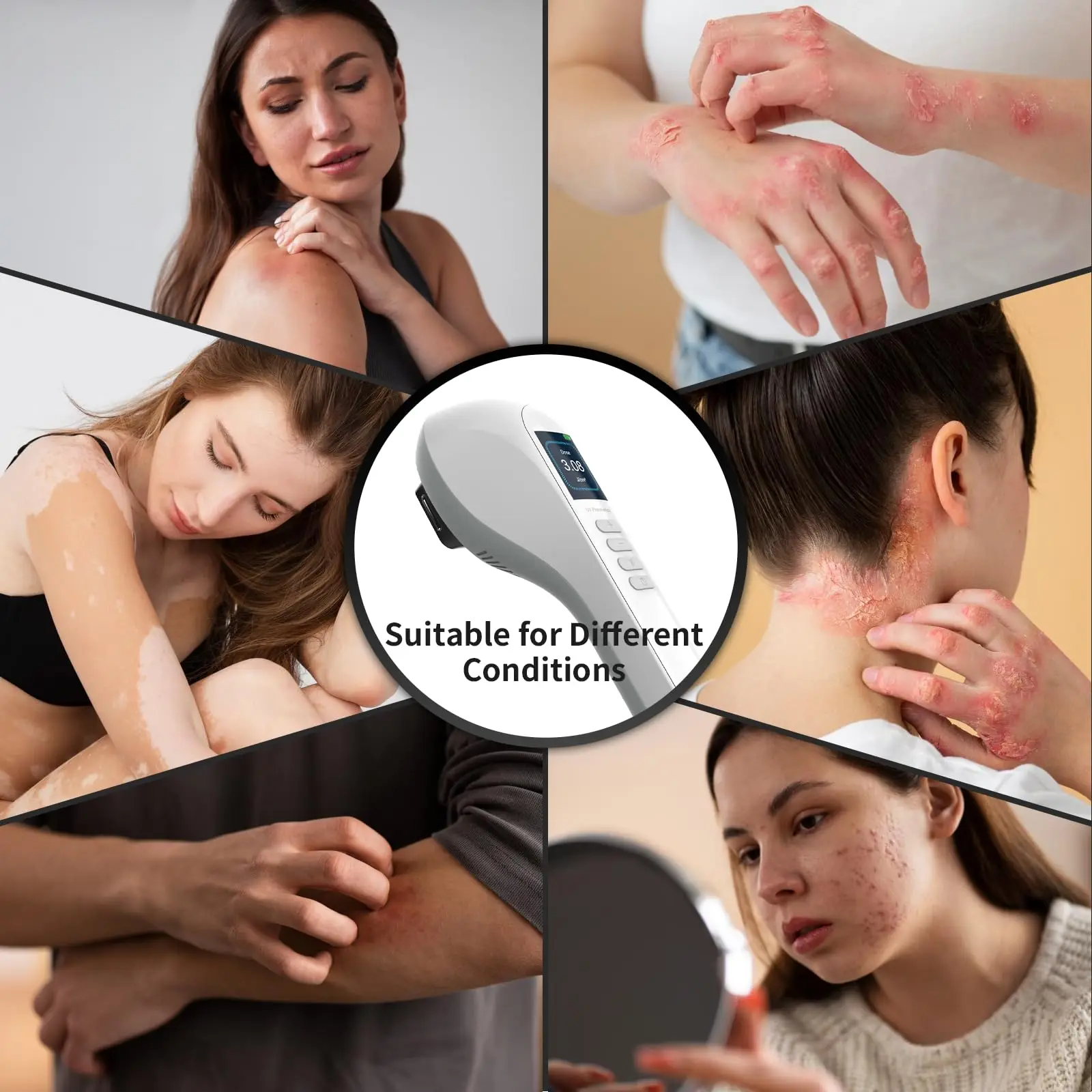 

308nm UV Light for Vitiligo Handheld UVB Phototherapy Lamp with LCD Display&Timer Control Therapy Psoriasis Spots Eczema
