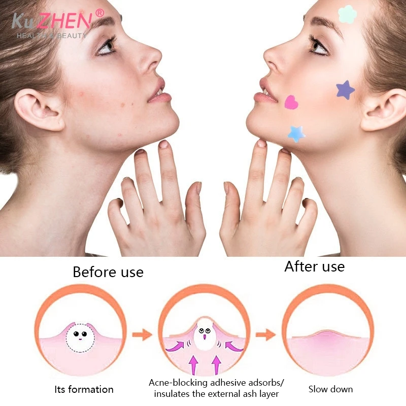 Colorful Special-Shaped Pimple Patch Acne Black Tea Tree Oil Hydrocolloid Skin Care Stickers Y2k Concealer Face Spot Beauty Tool